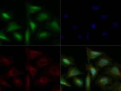 Invitrogen TLR4 Polyclonal Antibody 100 &mu;g | Buy Online | Invitrogen&trade; | Fisher Scientific