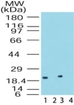 Invitrogen DUSP18 Polyclonal Antibody 100 &mu;g; Unconjugated:Antibodies,