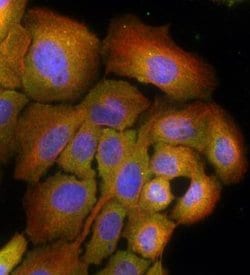 Invitrogen RAB7 Polyclonal Antibody 100 &mu;g; Unconjugated:Antibodies,