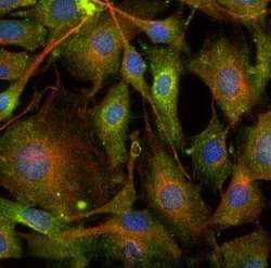 Invitrogen RAB7 Polyclonal Antibody 100 &mu;g | Buy Online | Invitrogen&trade; | Fisher Scientific