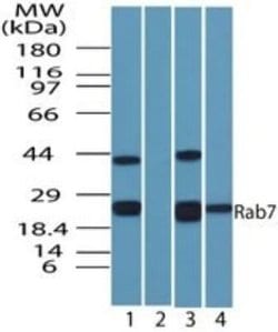 Invitrogen RAB7 Polyclonal Antibody 100 &mu;g; Unconjugated:Antibodies,