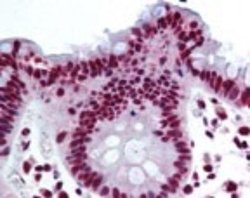 Invitrogen THRAP3 Polyclonal Antibody 100 &mu;g | Buy Online | Invitrogen&trade; | Fisher Scientific