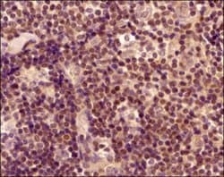 Invitrogen ROR gamma Polyclonal Antibody 100 &mu;g; Unconjugated:Antibodies,