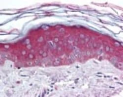 Invitrogen ARHGEF11 Polyclonal Antibody 100 μg; Unconjugated:Antibodies,