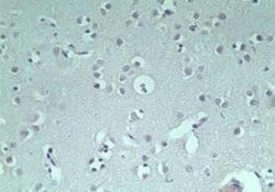 Invitrogen RNF128 Polyclonal Antibody 100 &mu;g; Unconjugated:Antibodies,