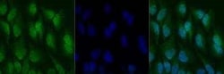 Invitrogen NFkB p65 Polyclonal Antibody 100 &mu;g; Unconjugated:Anticuerpos