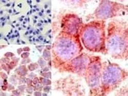 Invitrogen NFkB p65 Polyclonal Antibody 100 &mu;g; Unconjugated:Anticuerpos