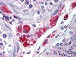 Invitrogen HIPK3 Polyclonal Antibody 100 &mu;g; Unconjugated:Antibodies,