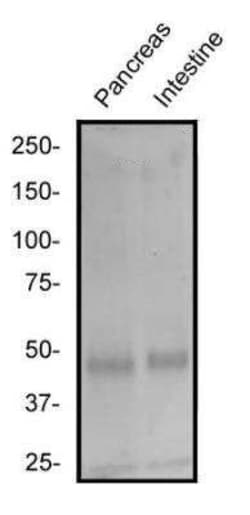 Invitrogen c-MAF Polyclonal Antibody 100 &mu;g; Unconjugated:Anticuerpos