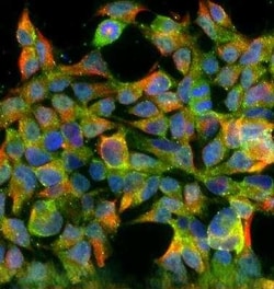 Invitrogen TGR5 Polyclonal Antibody 100 &mu;L | Buy Online | Invitrogen&trade; | Fisher Scientific