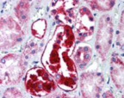 Invitrogen ATG5 Polyclonal Antibody 100 &mu;g; Unconjugated:Antibodies,