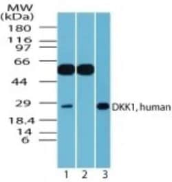 Invitrogen DKK1 Polyclonal Antibody 100 &mu;g; Unconjugated:Antikroppar