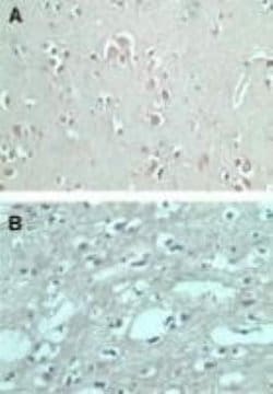 Invitrogen FMNL2 Polyclonal Antibody 100 μg; Unconjugated:Antibodies,