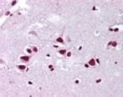 Invitrogen FMNL2 Polyclonal Antibody 100 μg; Unconjugated:Antibodies,