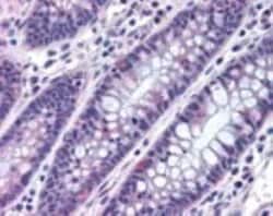 Invitrogen MTSS1 Polyclonal Antibody 100 &mu;g; Unconjugated:Antibodies,