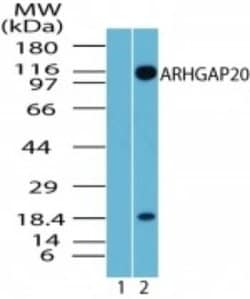 Invitrogen ARHGAP20 Polyclonal Antibody 100 &mu;g; Unconjugated:Antibodies,