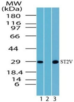 Invitrogen ST2 Polyclonal Antibody 100 &mu;g; Unconjugated:Antibodies,