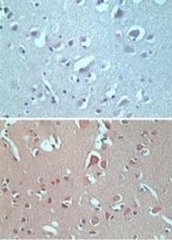 Invitrogen VANGL2 Polyclonal Antibody 100 &mu;g; Unconjugated:Antibodies,