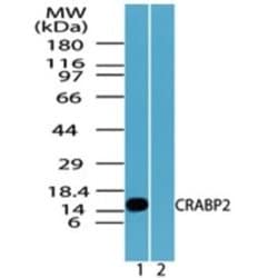 Invitrogen CRABP2 Polyclonal Antibody 100 &mu;g; Unconjugated:Antibodies,