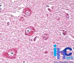 Invitrogen DACT1 Polyclonal Antibody 100 μg; Unconjugated:Antibodies,