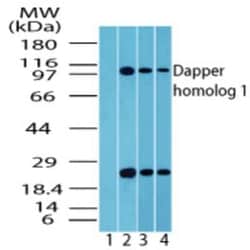 Invitrogen DACT1 Polyclonal Antibody 100 &mu;g | Buy Online | Invitrogen&trade; | Fisher Scientific