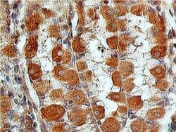 Invitrogen LGR7 Polyclonal Antibody 100 &mu;L; Unconjugated:Antibodies,