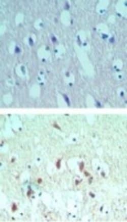 Invitrogen eIF4A2 Polyclonal Antibody 100 &mu;g; Unconjugated:Antibodies,