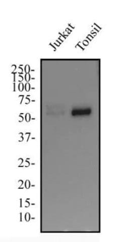 Invitrogen IKZF3 Polyclonal Antibody 100 &mu;g; Unconjugated:Antibodies,