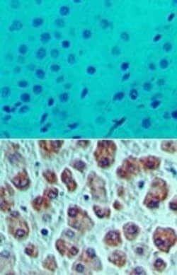Invitrogen eIF4A1 Polyclonal Antibody 100 &mu;g; Unconjugated:Antibodies,