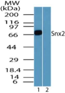 Invitrogen SNX2 Polyclonal Antibody 100 &mu;g | Buy Online | Invitrogen&trade; | Fisher Scientific