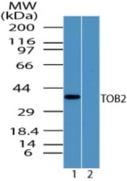Invitrogen TOB2 Polyclonal Antibody 100 &mu;g | Buy Online | Invitrogen&trade; | Fisher Scientific