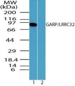 Invitrogen GARP Polyclonal Antibody 100 &mu;g; Unconjugated:Antibodies,