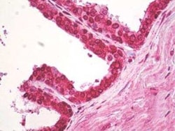 Invitrogen ACAP2 Polyclonal Antibody 100 &mu;g; Unconjugated:Antibodies,