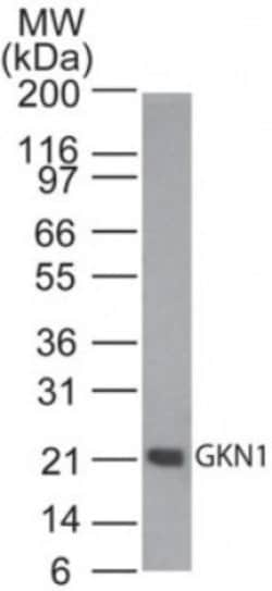 Invitrogen GKN1 Polyclonal Antibody 100 &mu;g | Buy Online | Invitrogen&trade; | Fisher Scientific