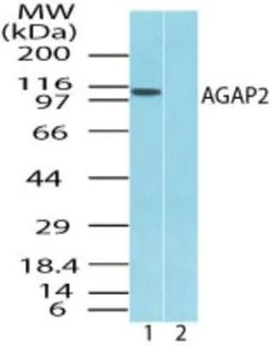 Invitrogen CENTG1 Polyclonal Antibody 100 &mu;g | Buy Online | Invitrogen&trade; | Fisher Scientific