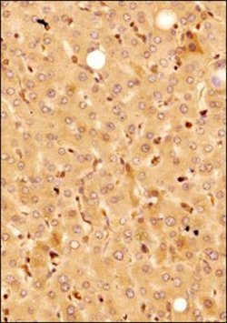 Invitrogen KLF15 Polyclonal Antibody 100 &mu;g | Buy Online | Invitrogen&trade; | Fisher Scientific