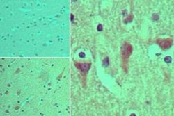 Invitrogen ASAP3 Polyclonal Antibody 100 &mu;g; Unconjugated:Antibodies,