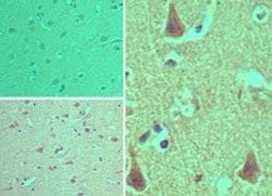 Invitrogen ARAP2 Polyclonal Antibody 100 &mu;g; Unconjugated:Antibodies,