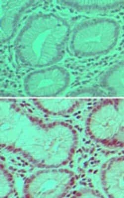 Invitrogen USP7 Polyclonal Antibody 100 &mu;g; Unconjugated:Antibodies,