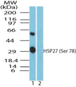 Invitrogen Phospho-HSP27 (Ser78) Polyclonal Antibody 20 &mu;g | Buy Online | Invitrogen&trade; | Fisher Scientific