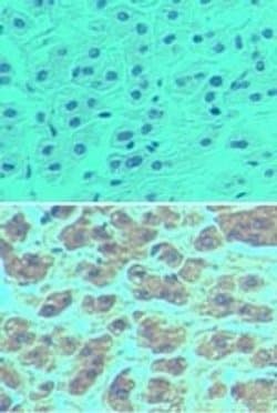 Invitrogen NALP11 Polyclonal Antibody 100 &mu;L; Unconjugated:Antibodies,