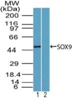 Invitrogen SOX9 Polyclonal Antibody 100 &mu;g | Buy Online | Invitrogen&trade; | Fisher Scientific