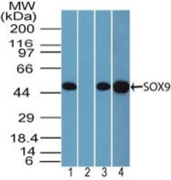 Invitrogen SOX9 Polyclonal Antibody 100 &mu;g | Buy Online | Invitrogen&trade; | Fisher Scientific