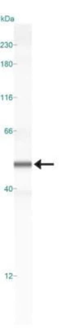 Invitrogen SOX9 Polyclonal Antibody 100 &mu;g | Buy Online | Invitrogen&trade; | Fisher Scientific