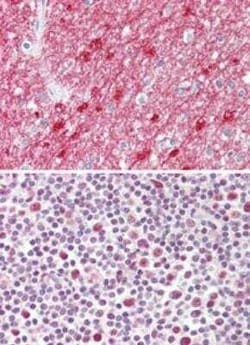 Invitrogen TCF19 Polyclonal Antibody 100 &mu;g; Unconjugated:Anticuerpos