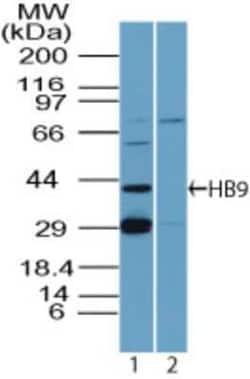 Invitrogen HB9 Polyclonal Antibody 100 &mu;g; Unconjugated:Anticorps, Polyclonal
