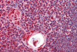 Invitrogen hnRNP K Polyclonal Antibody 100 &mu;g | Buy Online | Invitrogen&trade; | Fisher Scientific