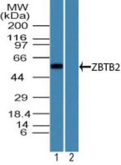 Invitrogen ZBTB2 Polyclonal Antibody 100 &mu;g; Unconjugated:Antibodies,