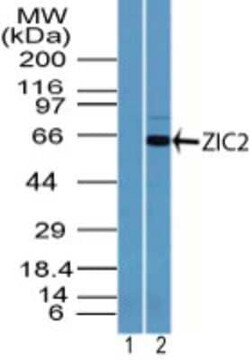 Invitrogen ZIC2 Polyclonal Antibody 100 &mu;g | Buy Online | Invitrogen&trade; | Fisher Scientific