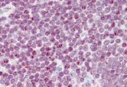 Invitrogen Histone H2A.X Polyclonal Antibody 100 &mu;g | Buy Online | Invitrogen&trade; | Fisher Scientific